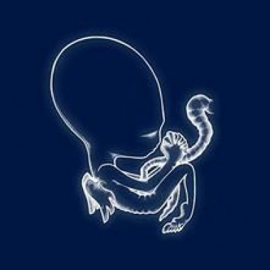 Sigur Rós • Ágatis Byrjun (2LP)